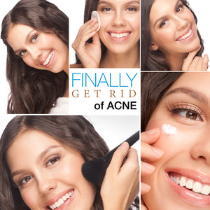 Topical Gel for Acne Containing Dead Sea Mineral Salt